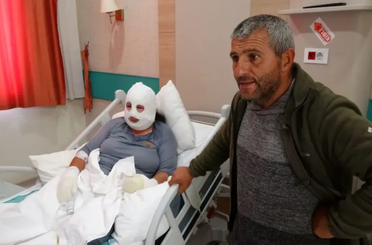 Kızını kurtarmak için alevlerin arasına girdi: Elleri ve yüzü yandı